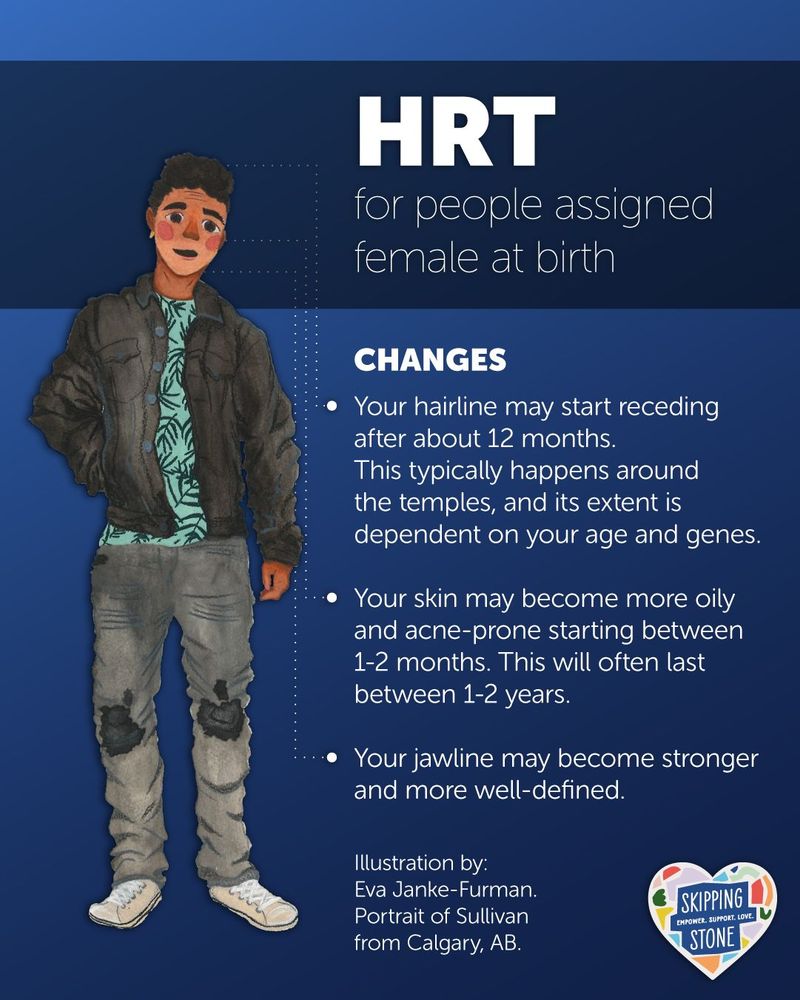 HRT for people assigned female at birth. Changes. Your hairline may start receding after about 12 months. This typically happens around the temples, and its extent is dependent on your age and genes. Your skin may become more oily and acne-prone starting between 1 to 2 months. This will often last between 1 to 2 years. Your jawline may become stronger and more well-defined. Illustration by: Eva Janke-Furman. Portrait of Sullivan from Calgary, AB.