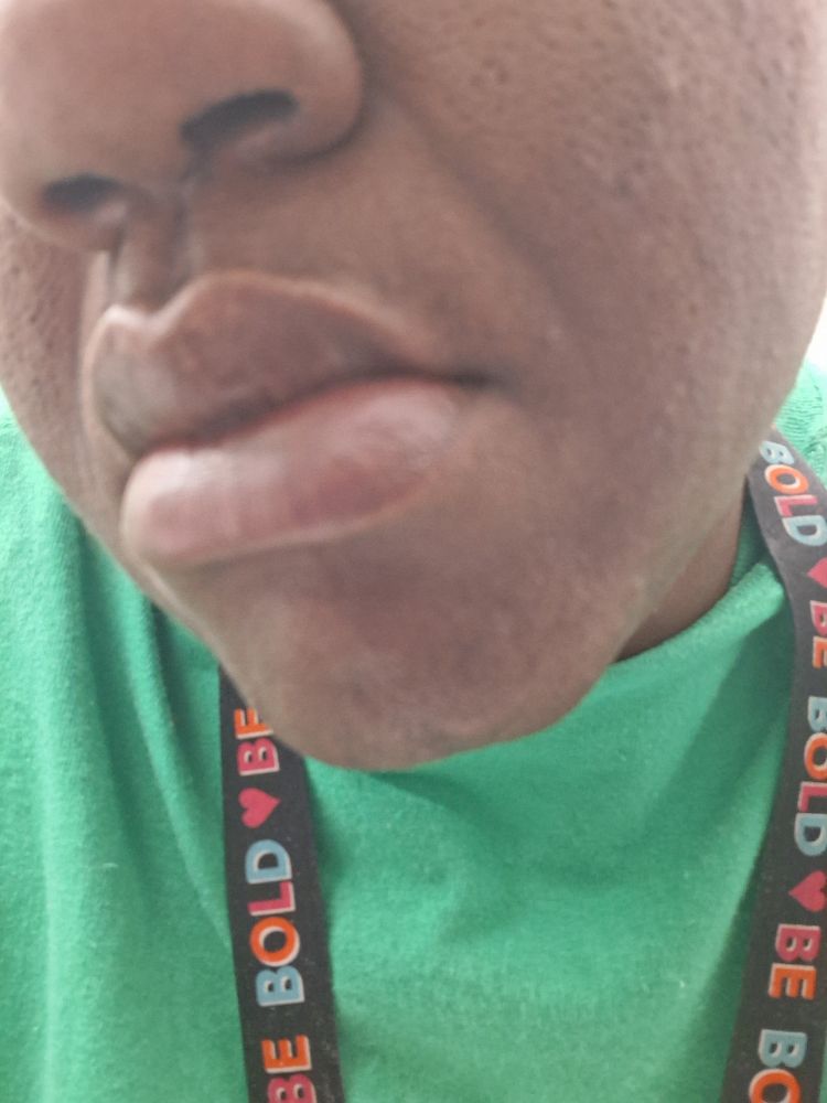 Lips close up, what would you like?
