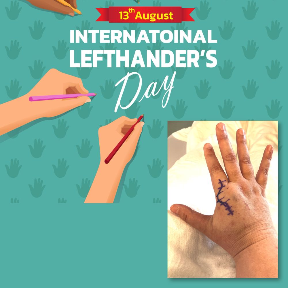 Illustrated poster-style graphic for International Lefthanders Day, superimposed by a photo of my right hand, marked up in preparation for surgery.