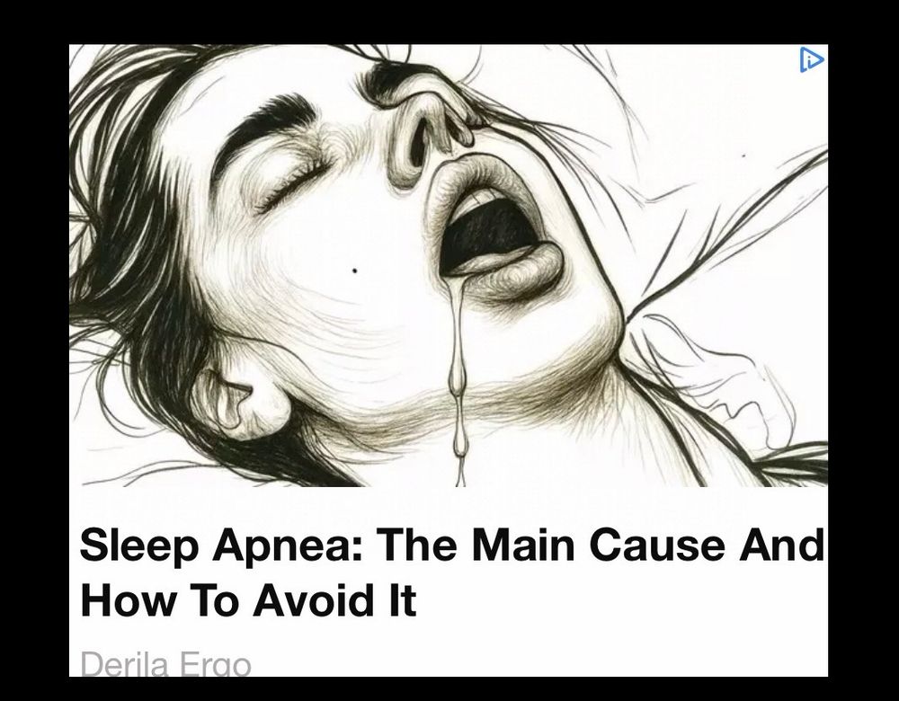 Drawing of someone in full makeup lying on their back with tons of drool dripping from a super lipsticky mouth

CAPTION: Sleep Apnea: The Main Cause And How To Avoid It 