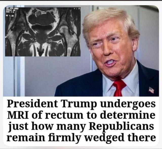 President Trump undergoes MRI of rectum to determine just how many Republicans remain firmly wedged there.