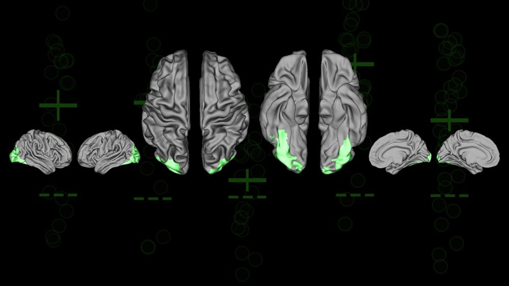 Brain scans like these helped scientists classify how study participants made decisions