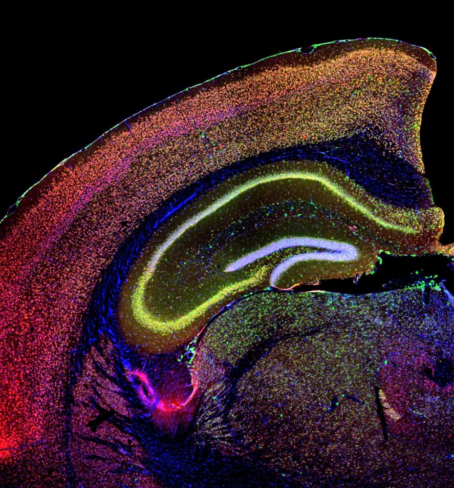 Adding DNA pieces (green and yellow) to the brain’s memory center helped mice lacking a segment of DNA, mimicking a human condition linked to a missing chunk of chromosome 22.