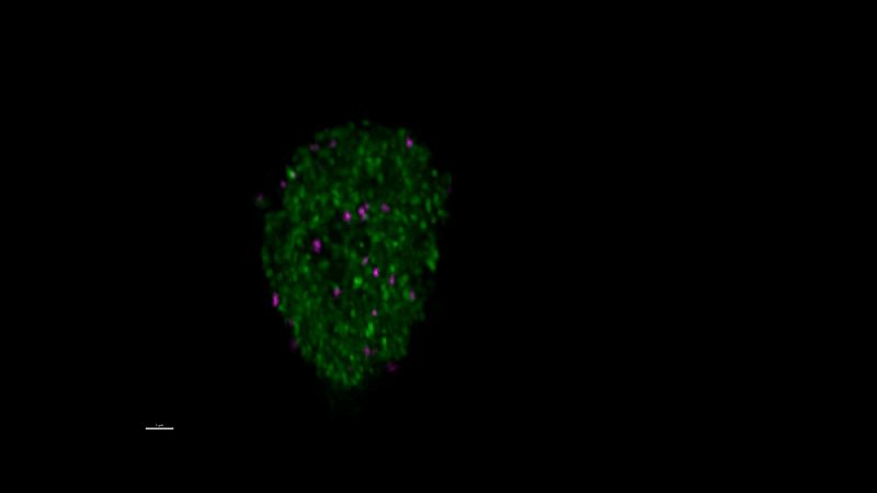 A mouse olfactory neuron, with solid condensates less than five days old (green) and more than five days old (magenta).
