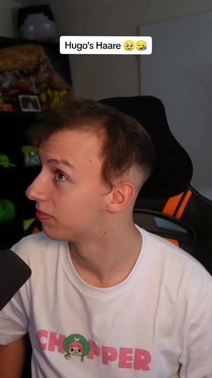 Ein bild von LetsHugo mit starkem haarausfall