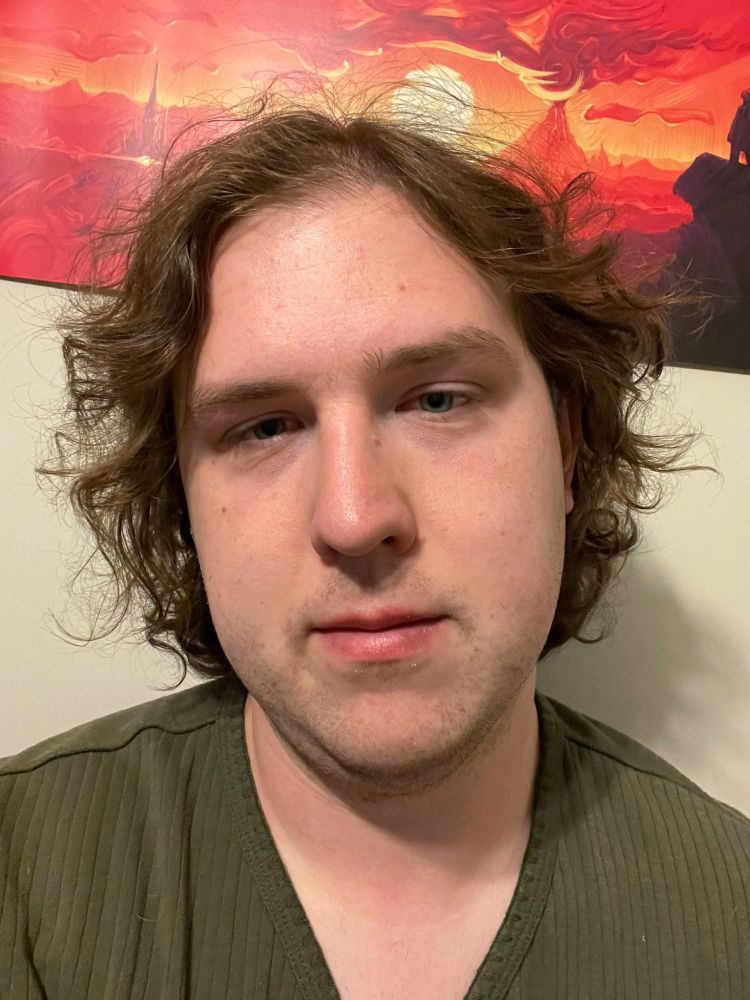 A selfie of Lyra on the first day of taking HRT. Still pre-HRT, looking fairly disheveled with visible stubble, and short unkempt hair. Still unsure how to look at the camera, Lyra has shadows over the eyes and is looking underneath the camera from straight on.