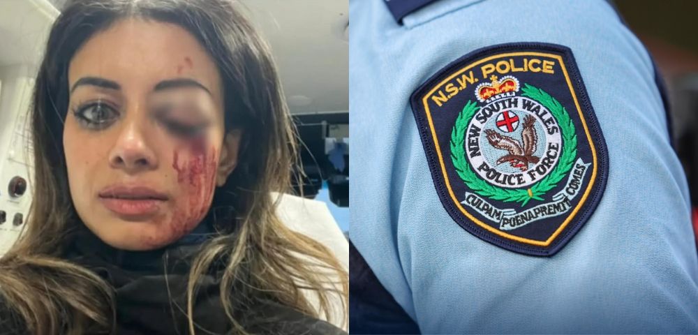 Greens candidate Hannah Thomas with a swollen and bloodied eye after being bashed by New South Wales police at an anti-weapons demonstration.