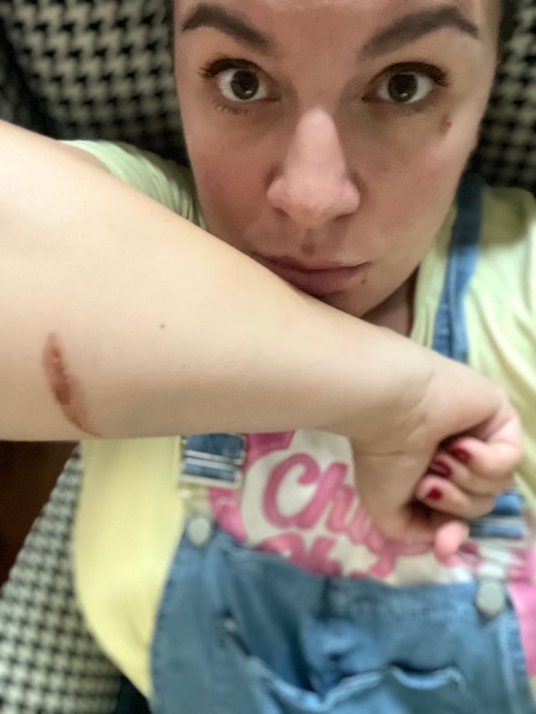 Selfie, den Arm zeigend. Latz-Jeans und gelbes Shirt mit rosa-weißem Chupa Chups - Aufdruck.