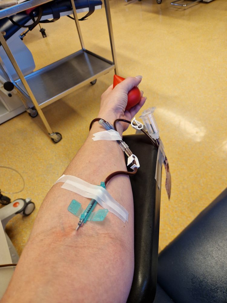 Mein linker Arm mit Nadel in der Vene bei der Thrombozytenspende 