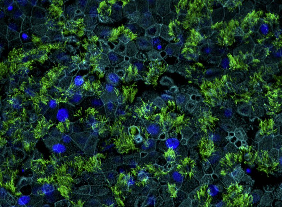 Microscopy imaging of human bronchial cells with TMPRRS2 staining in green, by Vincent Michel and colleagues.