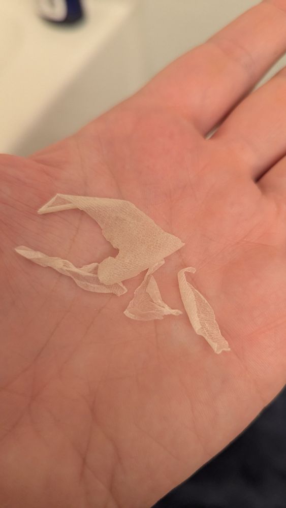 a hand holding bits of peeled skin