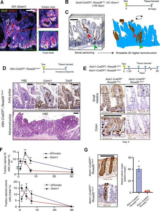 Epithelial GREMLIN1 disrupts intestinal epithelial-mesenchymal crosstalk to induce a wnt-dependent ectopic stem cell niche through stromal remodelling | Nature Communications