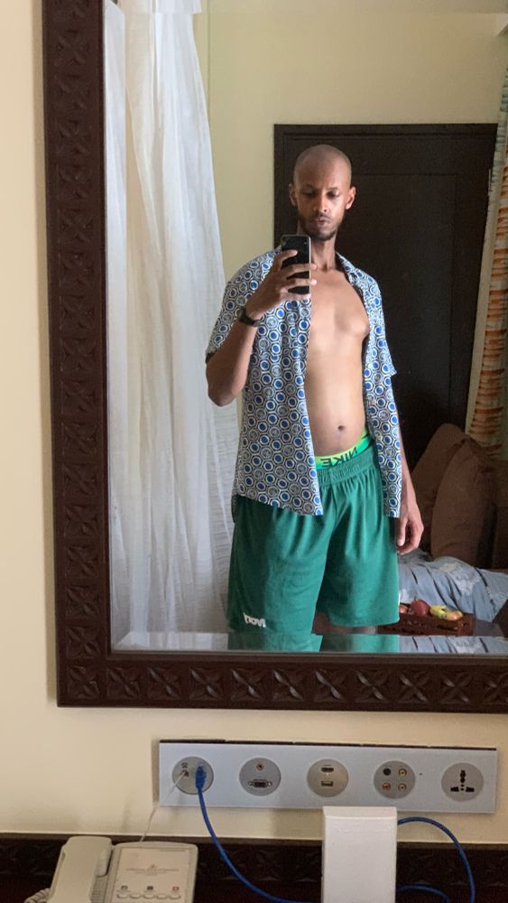 a bald headed hoe stands is taking a selfie in a hotel room mirror. they are wearing an unbottoned blue shirt and green shorts. they have a very serious look on their face. 