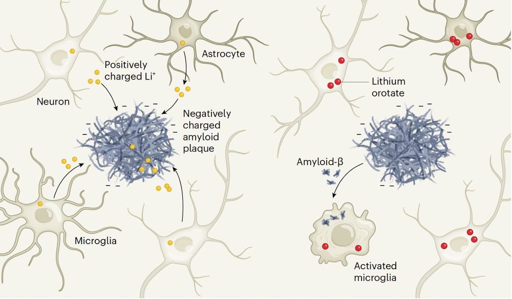 lithium ion trapped by beta-amyloid and the way to get around it