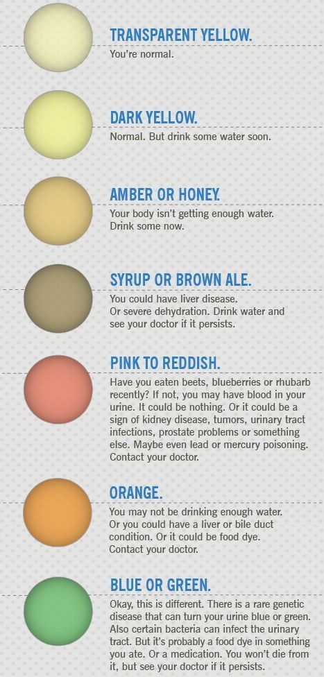 TRANSPARENT YELLOW.
You re normal.
DARK YELLOW.
Normal. But drink some water soon.
AMBER OR HONEY.
Your body isn't getting enough water.
Drink some now.
SYRUP OR BROWN ALE.
You could have liver disease.
Or severe dehydration. Drink water and see your doctor if it persists.
PINK TO REDDISH.
Have you eaten beets, blueberries or rhubarb recently? If not, you may have blood in your urine. It could be nothing. Or it could be a sign of kidney disease, tumors, urinary tract infections, prostate problems or something else. Maybe even lead or mercury poisoning.
Contact your doctor.
ORANGE.
You may not be drinking enough water.
Or you could have a liver or bile duct condition. Or it could be food dye.
Contact your doctor.
BLUE OR GREEN.
Okay, this is different. There is a rare genetic disease that can turn your urine blue or green.
Also certain bacteria can infect the urinary tract. But it's probably a food dye in something you ate. Or a medication. You won't die from it, but see your doctor if it persists.