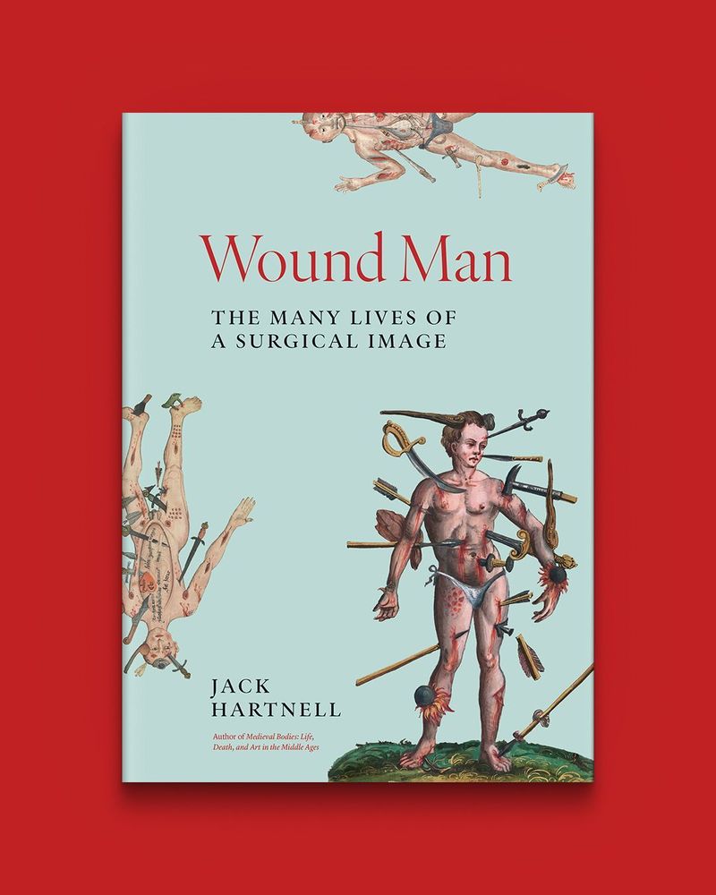 Wound Man: The Many Lives of a Surgical Image by Jack Hartnell