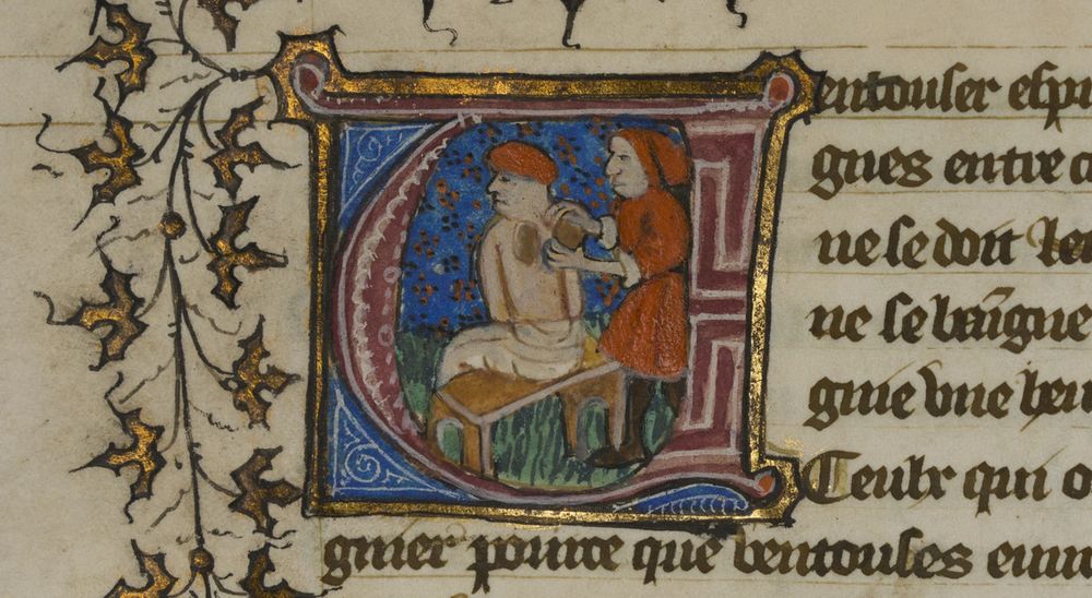

A doctor performing cupping on a patient's back in CUL, MS Ii.5.11 f. 20v.
