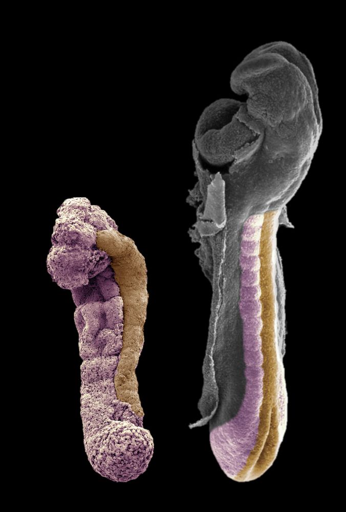Scanning electron microscope image of a human trunk-like structure (left) and human embryo (right) false coloured for somites (magenta) and neural tube (gold).