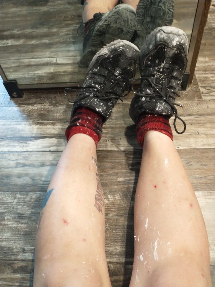 white stuff on my legs, red socks, and black shoes