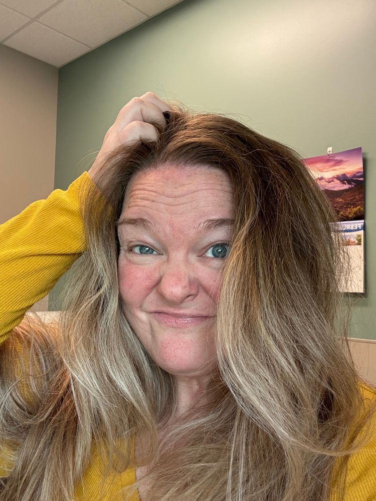 stephanie is wearing a yellow shirt and has her hair down. she is scratching her head and grimacing at the camera. she made her PCP dig through her scalp to see if she also has ringworm there and is we are pleased to announce that she is the lucky one of the group who does not have ringworm anywhere in her hair