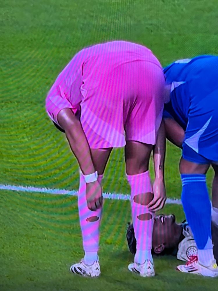 Jogador com meião rasgado.