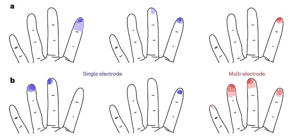 Figure showing that stimulating two electrodes at once evokes a sensation that approximates the sum of the sensations when each electrode is stimulated independently.