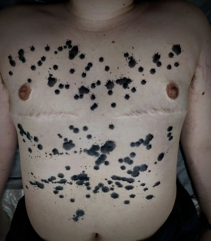 The chest and stomach of a person covered in black wax drops