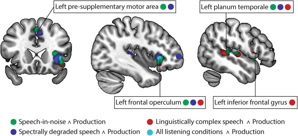 Engagement of the speech motor system in challenging speech perception: Activation likelihood estimation meta‐analyses