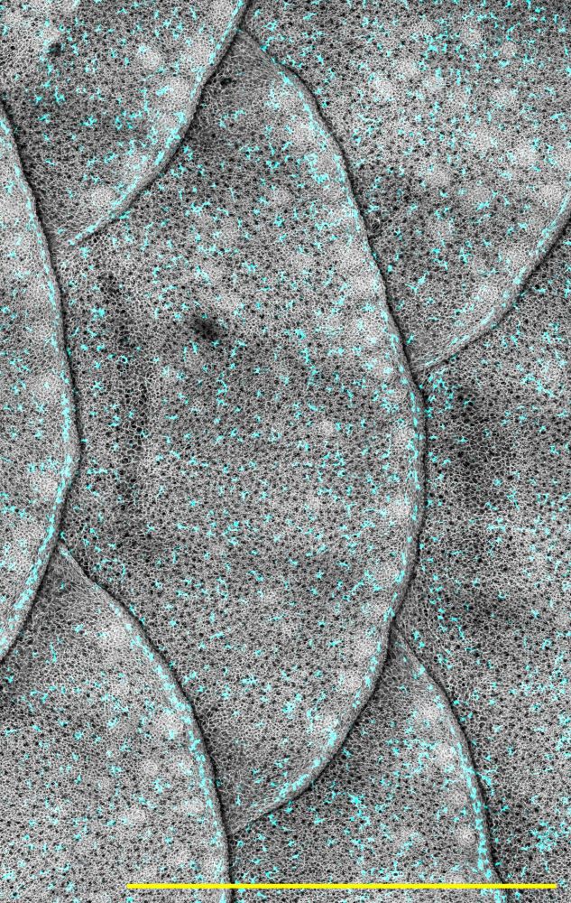 zebrafish skin in white, immune cells in cyan