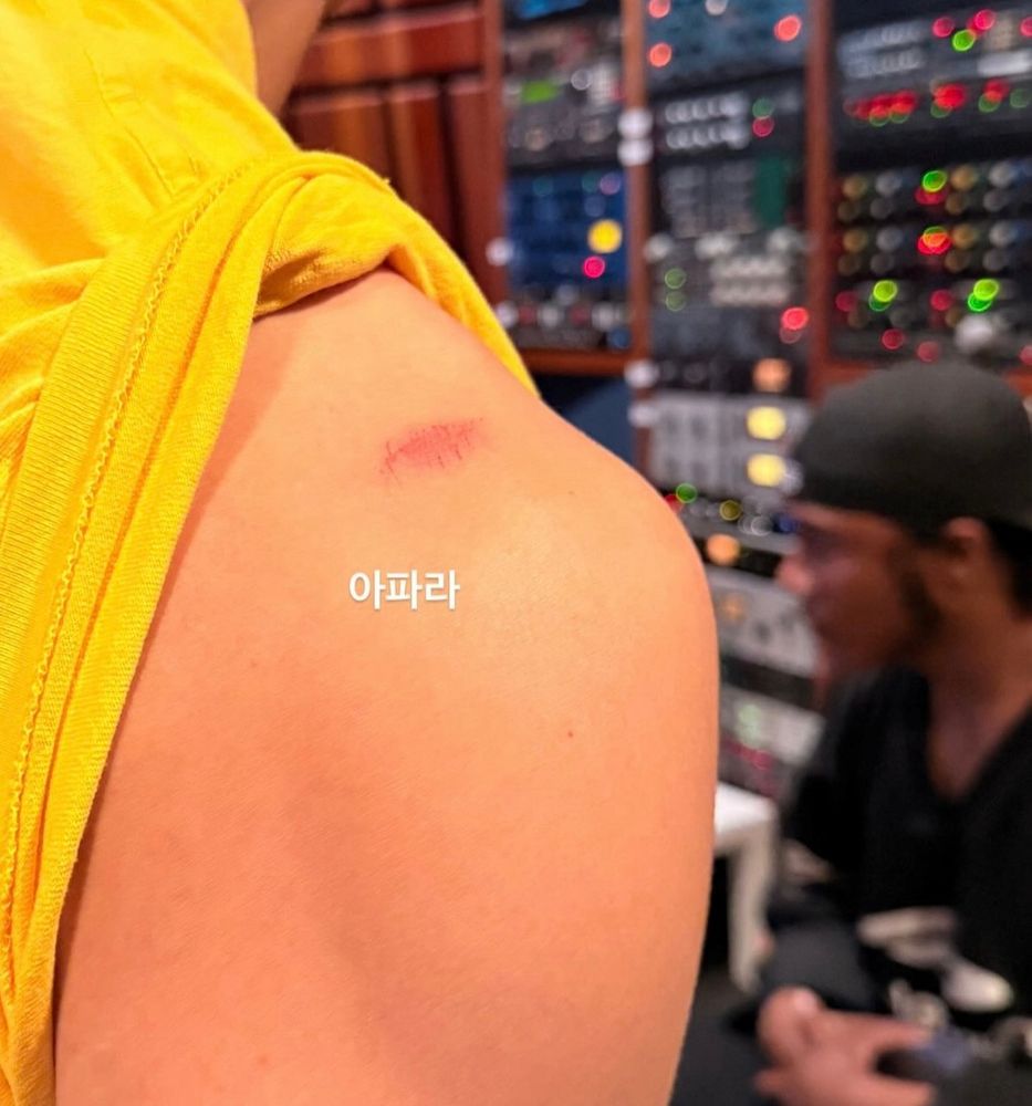 taehyung curling his yellow shirt to show his cut(?), burn (?), massive bug bite(?), mating bite (?) on his arm.