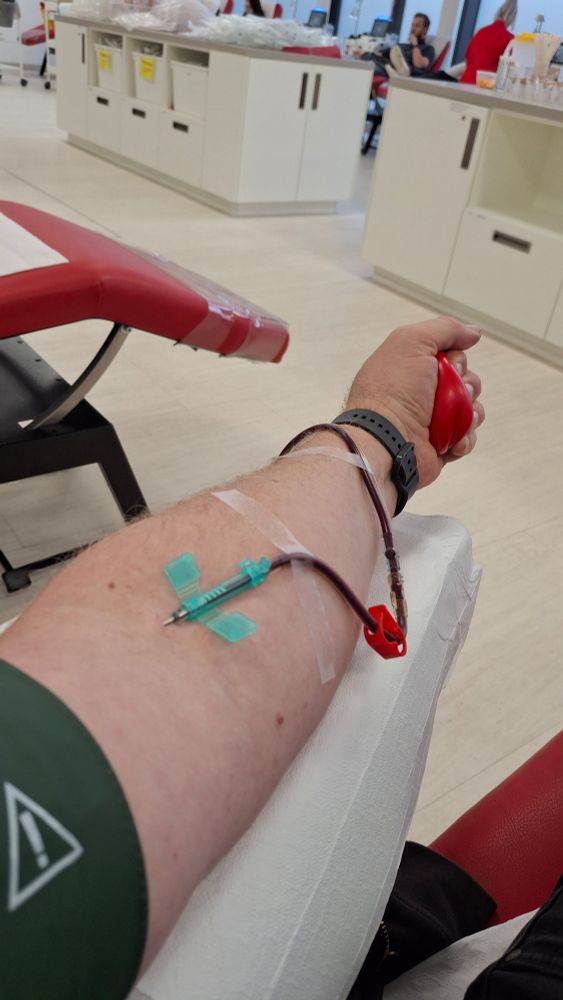 Ein Arm mit Nadel und Blutspendekanüle
