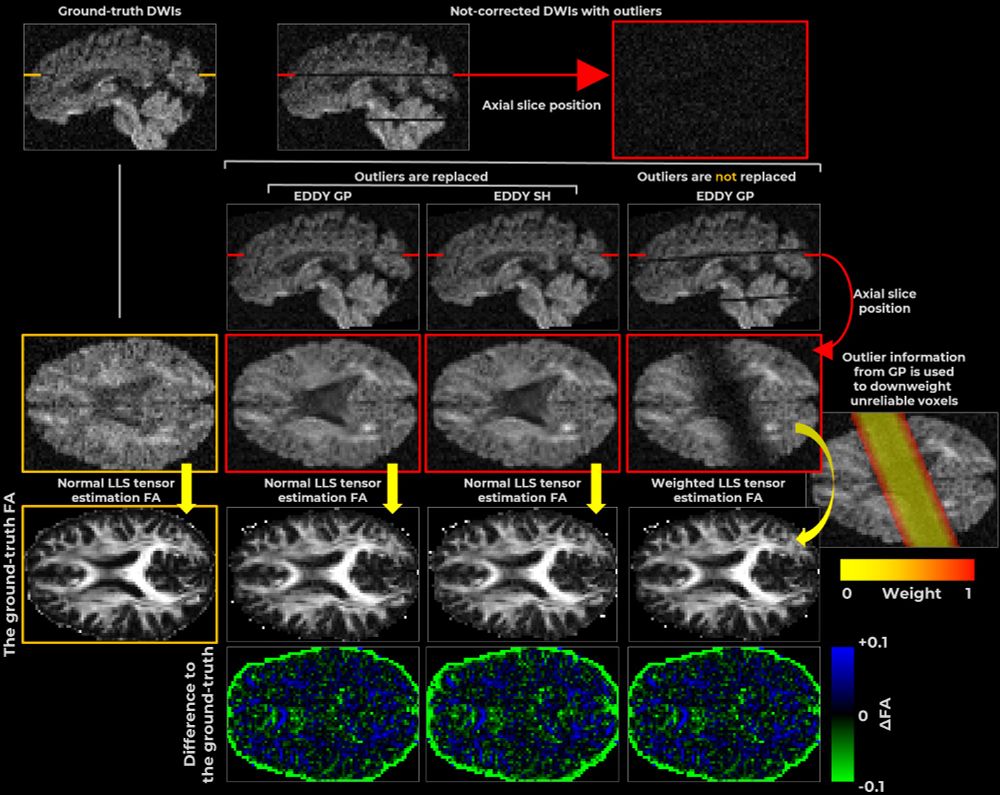 The outline of the experiments used in this study. Subject motion during a dMRI acquisition can cause slice-wise dropout artefacts. These artefacts can be remedied by using outlier replacement with different predictions e.g. from Gaussian Processes (GP) or from Spherical Harmonics (SH). Alternatively, an outlier position can be traced throughout the motion correction registrations and used to downweight such unreliable information during model estimation. We set out to investigate these different approaches using whole-brain simulations with the aim to find out which approach would the most beneficial to use in practice.