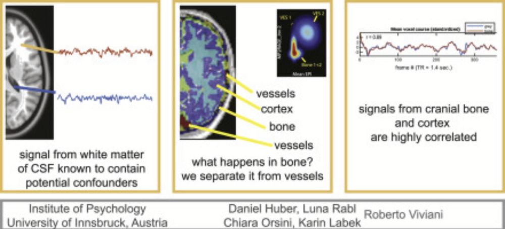 The fMRI global signal and its association with the signal from cranial bone