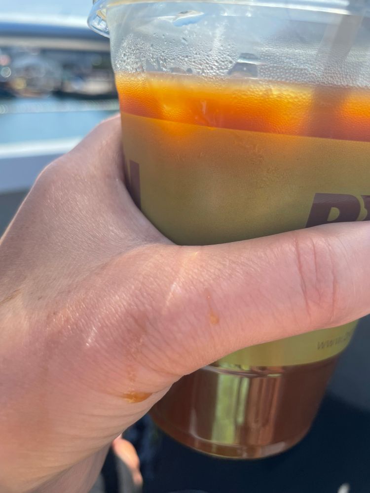 A left hand with multiple lil drips of iced coffee on it, cascading down in various trajectories with the mathmagical randomness of a waterfall’s meandering and powerfully-splayed path, demonstrating the multiplicity of possibility in this lifeworld full of unseen influence and constant yet subtle change