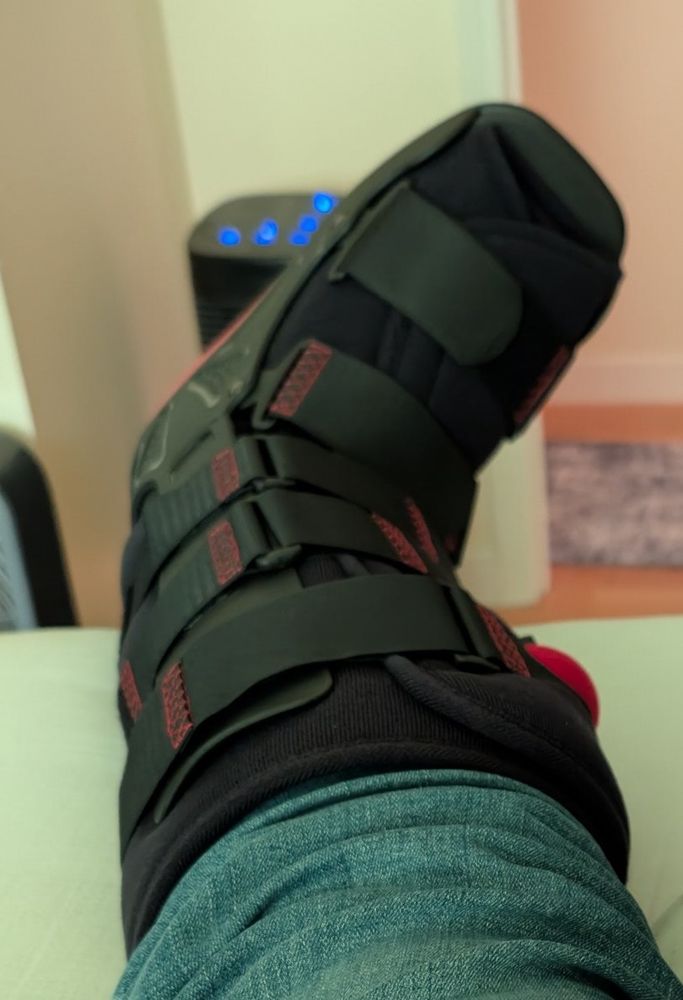 A closeup of a walking boot on a leg. It has almost enough straps to be designed by Nomura
