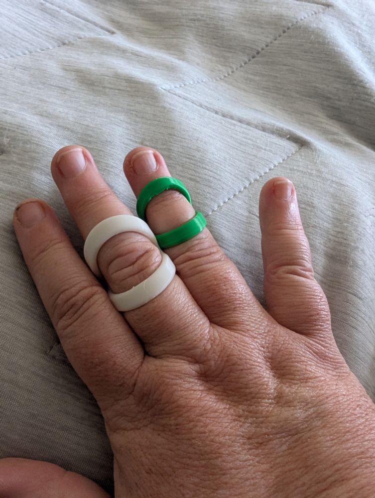A woman's hand with two white bands visible on the middle finger and two green bands visible on the ring finger