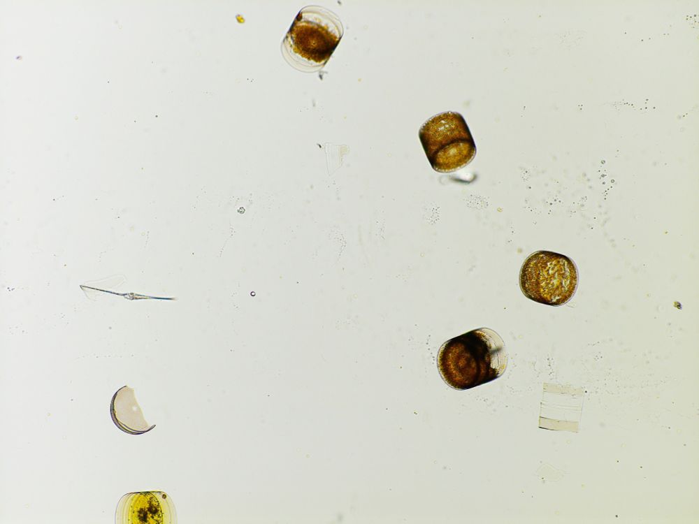 Image showing 5 diatom cells (Coscinodiscus sp.), Image by Loay Jabre.