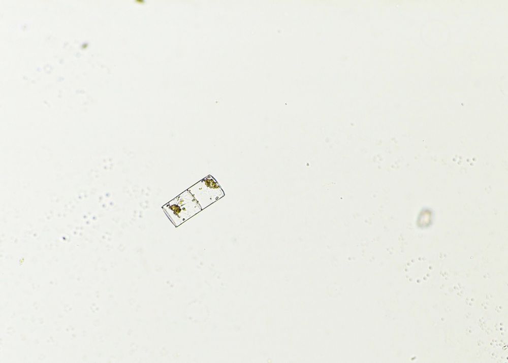 Image showing a diatom (possibly Guinardia sp.) Image by Loay Jabre.