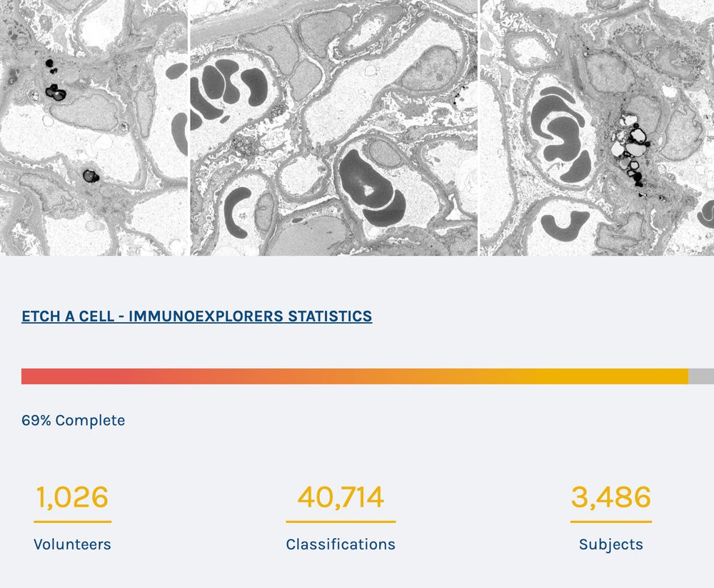 This image shows a screen grab of the Etch A Cell - ImmunoExplorers project page. You can see images of cells and the statistics mentioned in the post. 