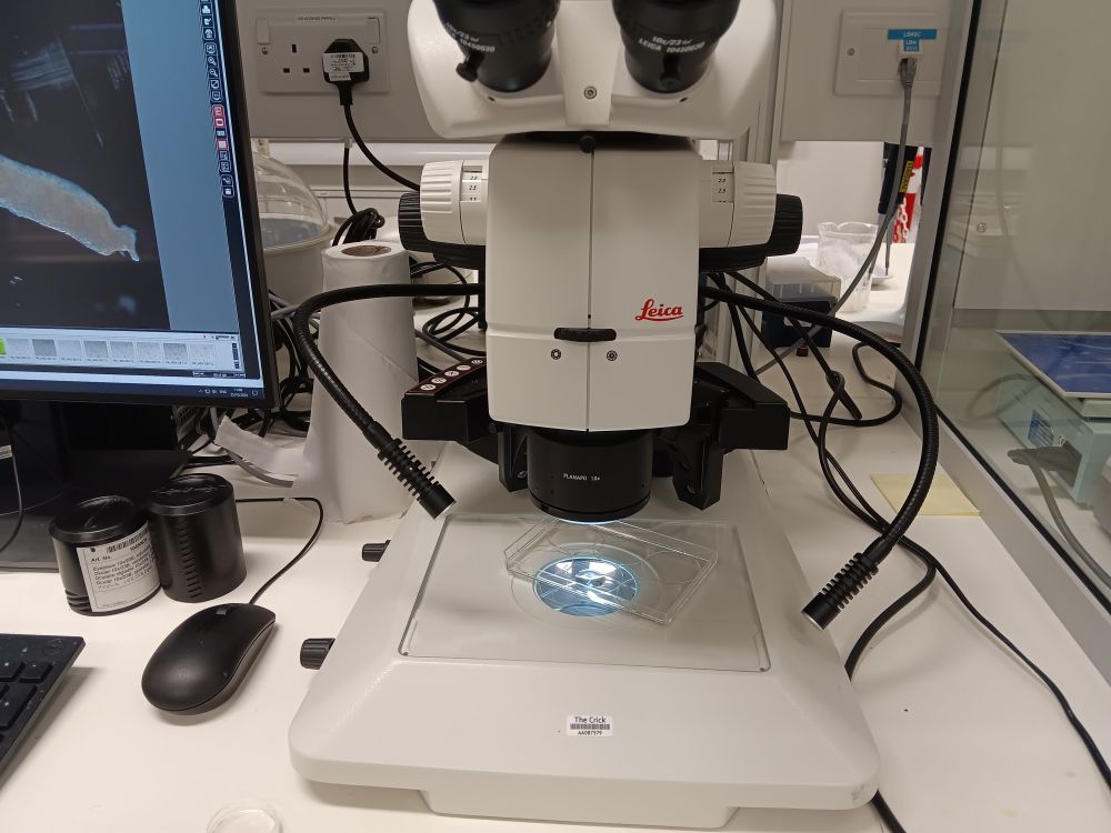 A biopsy being photographed using a dissection microscope which helps allows me to cut it into smaller pieces and catalogue the appearance of each piece.
