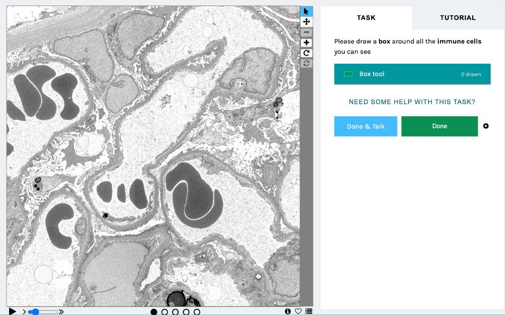 This image shows the classification interface for Etch A Cell - ImmunoExplorers. There is an image of kidney tissue on the left hand side and an interface on the right where you can select a box tool to mark up any immune cells in the image
