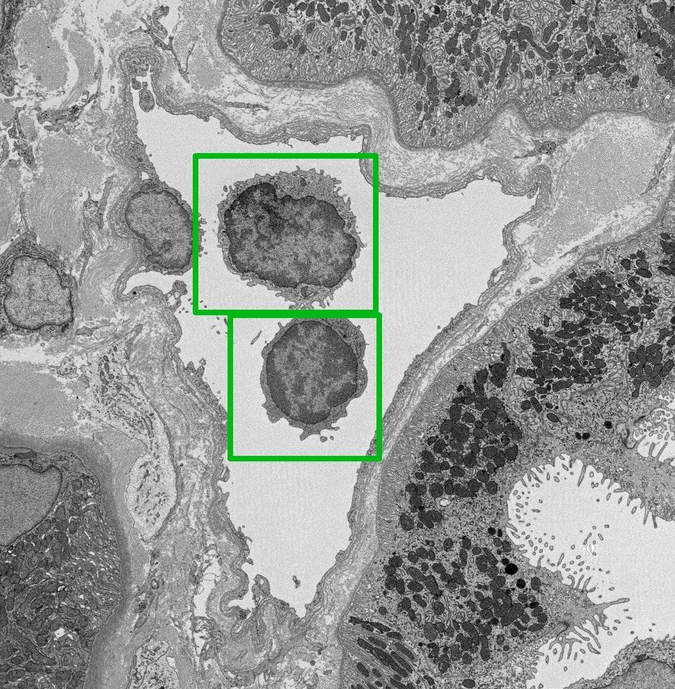 This image shows two immune cells in a kidney capillary. The immune cells each have a green box around them 