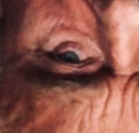 RFK’s eye. If you can’t see it, lucky you I guess.