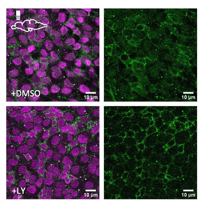 Translocation of the Notch3 Intracellular Domain (green) to the nucleus in adult neural stem cells (top), but retention at the membrane upon gamma-secretase inhibition (bottom).