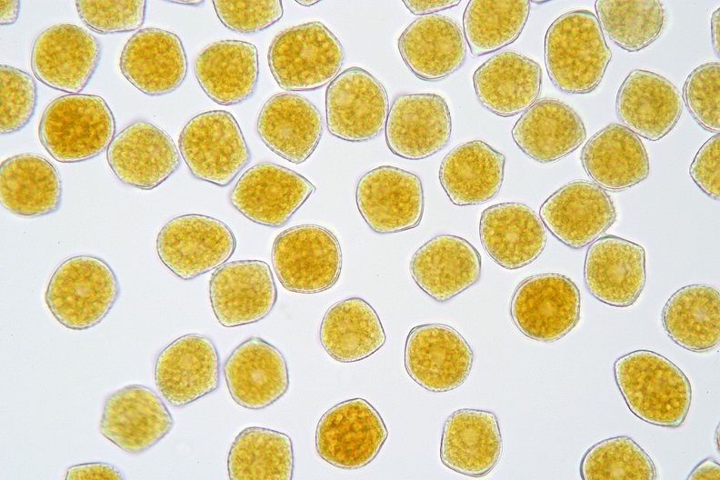 Bramble rust seen under the lens of a microscope.