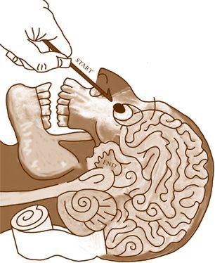 A cartoon maze made out of a mummy’s brain getting his brain removed with a long stick. It’s not graphic but it sure is funny to choose this as a kid’s workbook image.