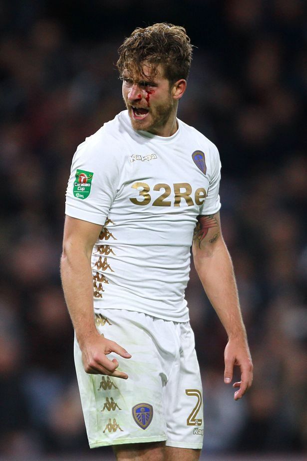 Leeds United's Gaetano Berardi with a cut on his eye.