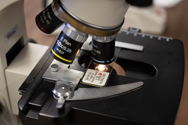 A close-up picture of a slide in a microscope. 
