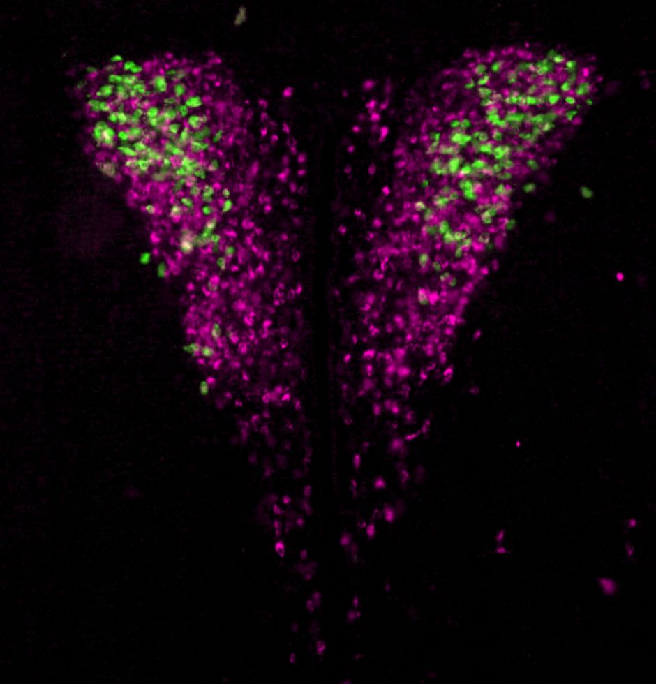 Hypothalamic neurons that control hormone secretion (magenta) and those that specifically control the release of the stress hormone cortisol (green). © Amelia Douglass