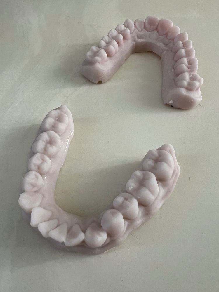 Two sets of casts of my upper and lower jaw made for a night guard sit on the counter of my bathroom sink.